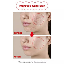 Load image into Gallery viewer, GD-11 CELL FACTORY CICA BLEMISH CLEANSING PACK (130ML)